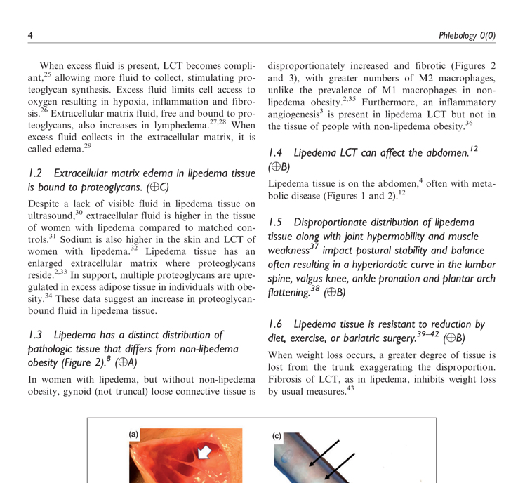 Lipedema_Standard_Of_Care_Image3